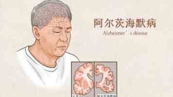 残留农药检测仪：在复杂食品体系中检测是否足够全面？